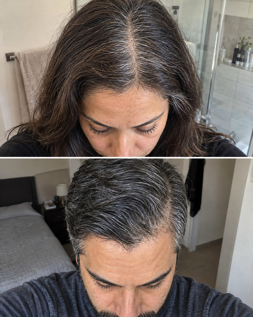 Antes