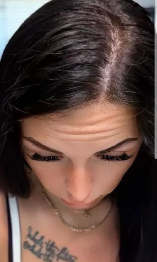 Después